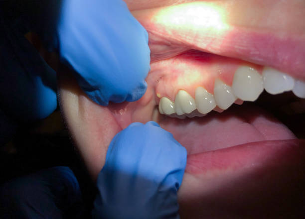 Best Emergency Treatment for Jaw Pain or Injury in Boulder, CO